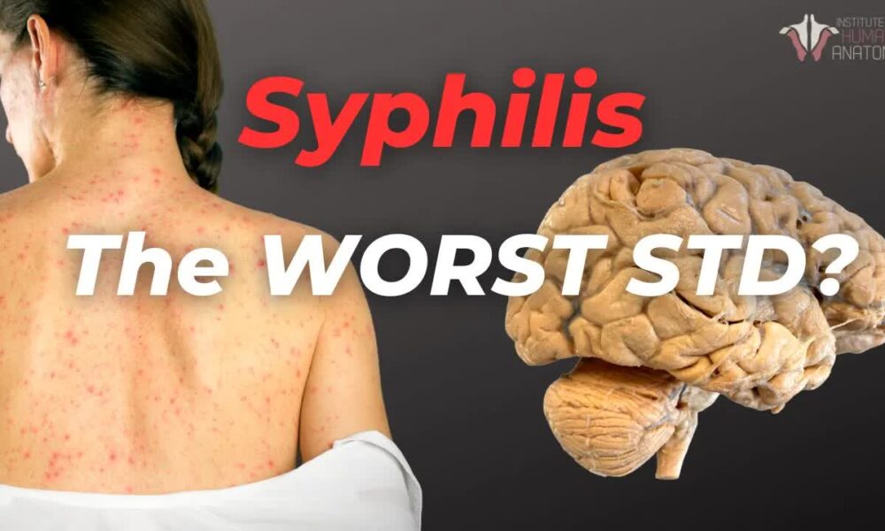 **Syphilis: The Silent Threat Among Us** - US News